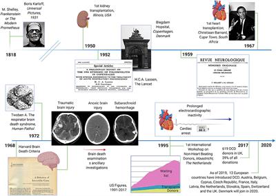 The Neurology of Death and the Dying Brain: A Pictorial Essay